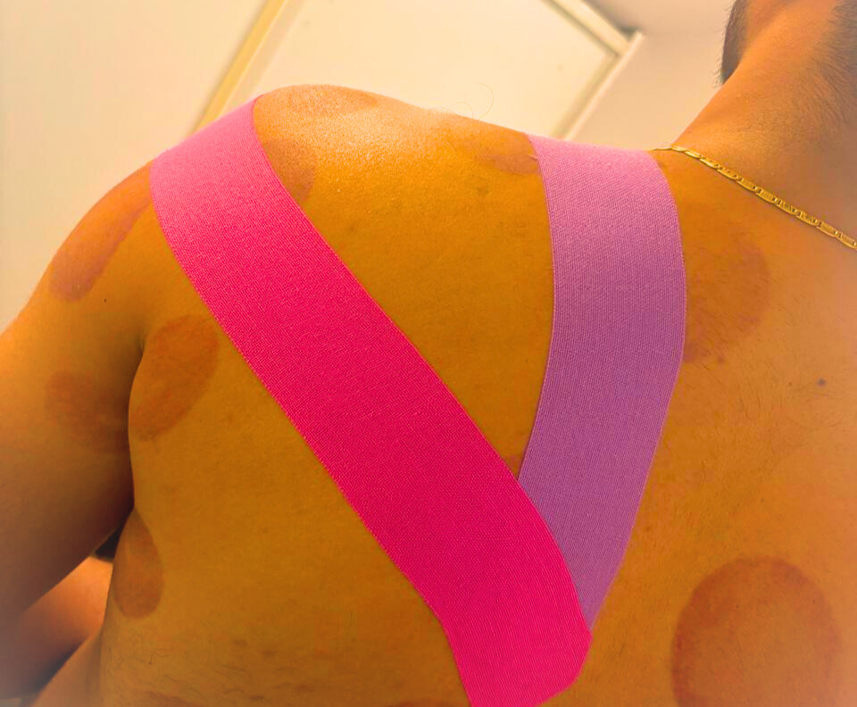 Pigmentation Treatment